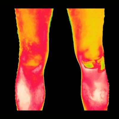 Baseline thermal, knees