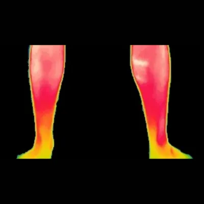Recovered thermal, calves