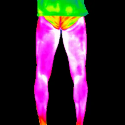Adductor overload thermal pattern