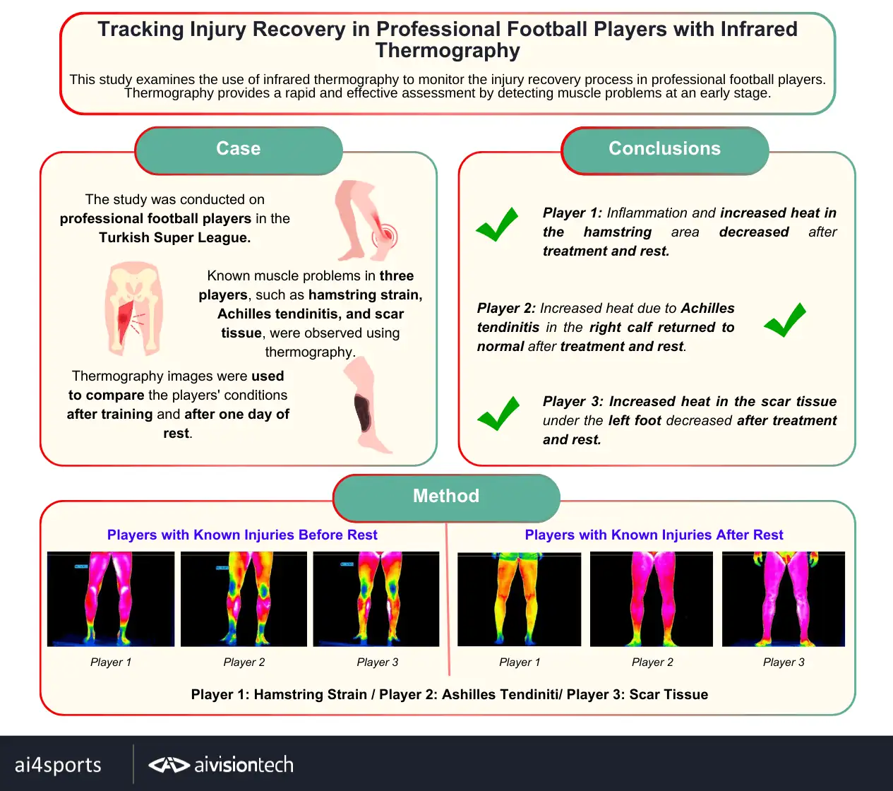 Profesyonel futbolcunun alt ekstremite iyileşme takibinde infrared termal görüntü