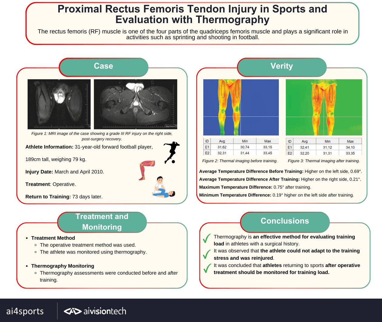 Sporda Proksimal Rektus Femoris Tendon Yaralanması ve Termografi ile Değerlendirme