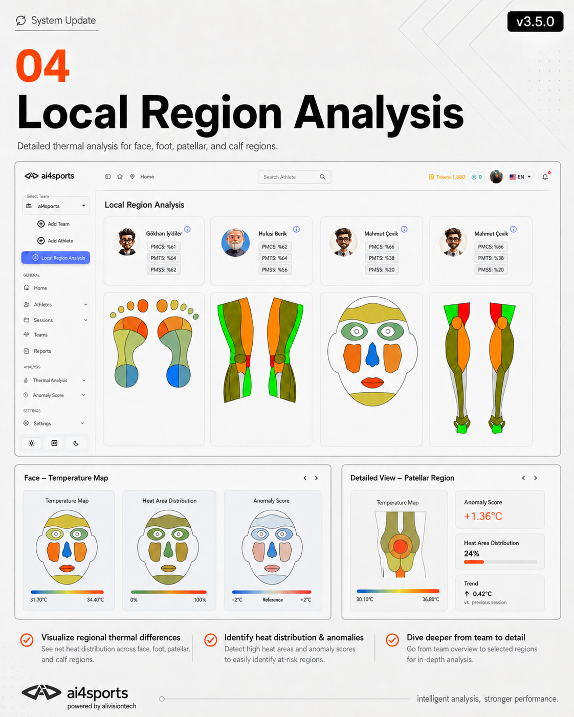 Thermographie et imagerie conventionnelle : quelles différences ? 4 Analyse locale des zones dans ai4sports