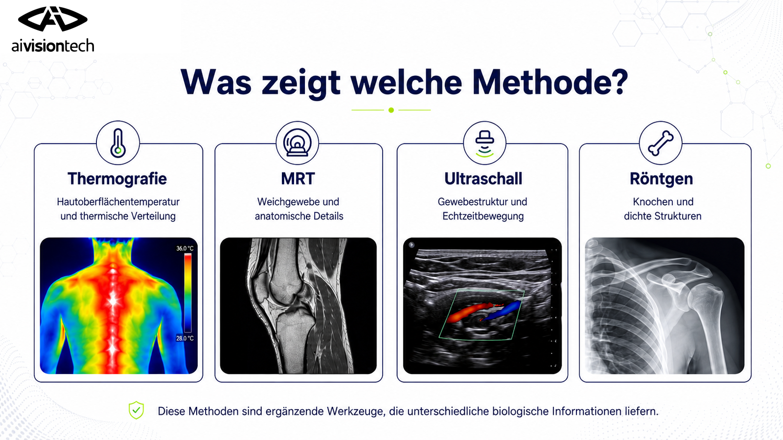 Thermografie und klassische Bildgebung im Vergleich 1 Vergleich von Thermografie, MRT, Ultraschall und Röntgen
