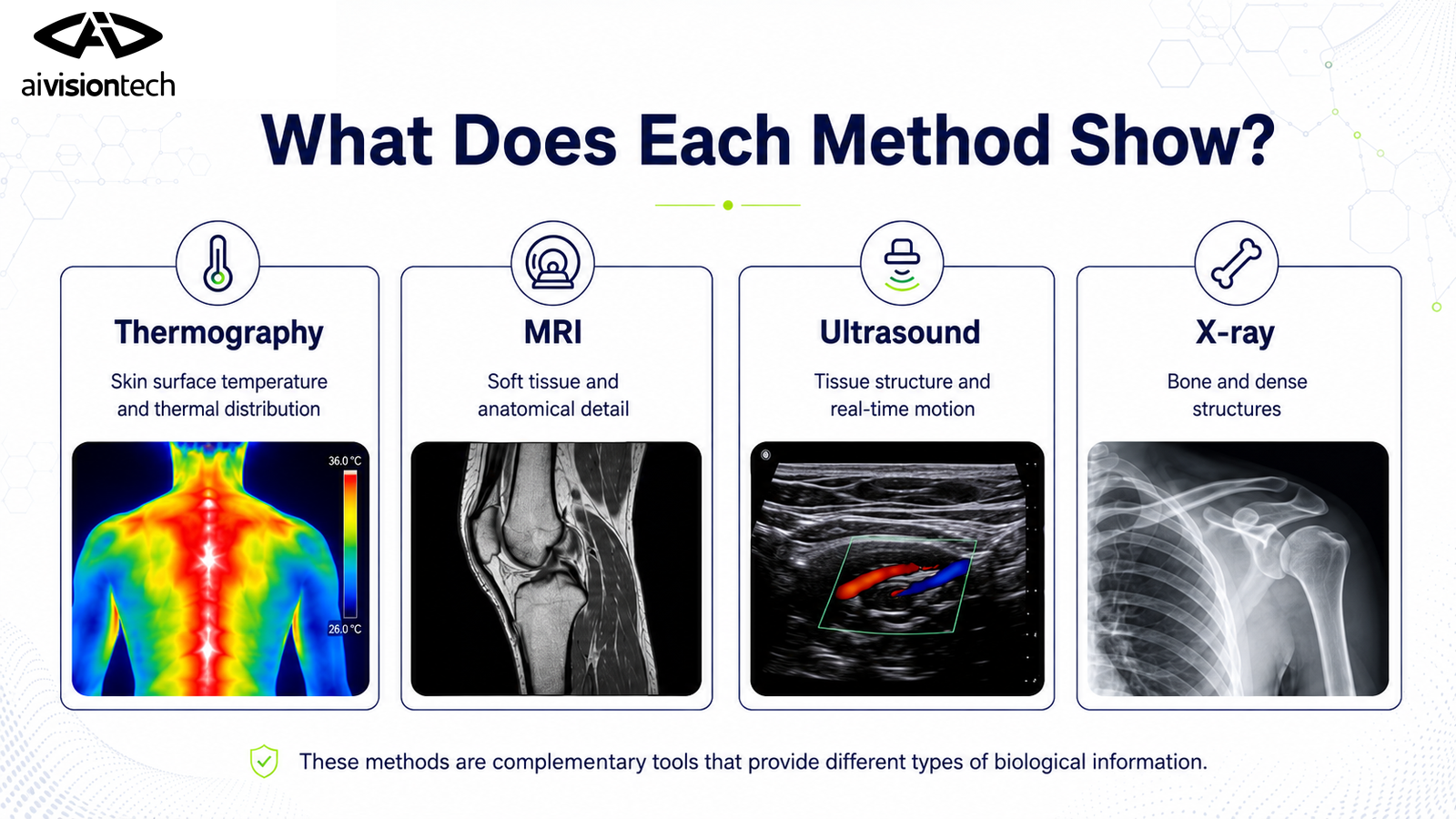 Thermography vs Conventional Imaging 1 Comparison of thermography, MRI, ultrasound and X-ray methods