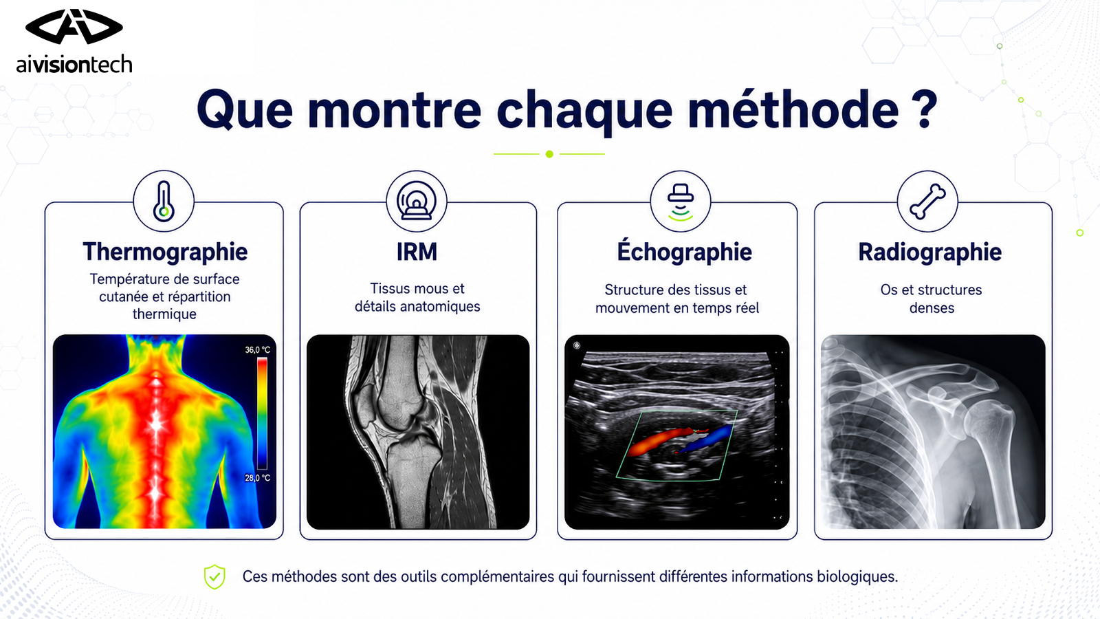 Thermographie et imagerie conventionnelle : quelles différences ? 1 Comparaison entre thermographie, IRM, échographie et radiographie