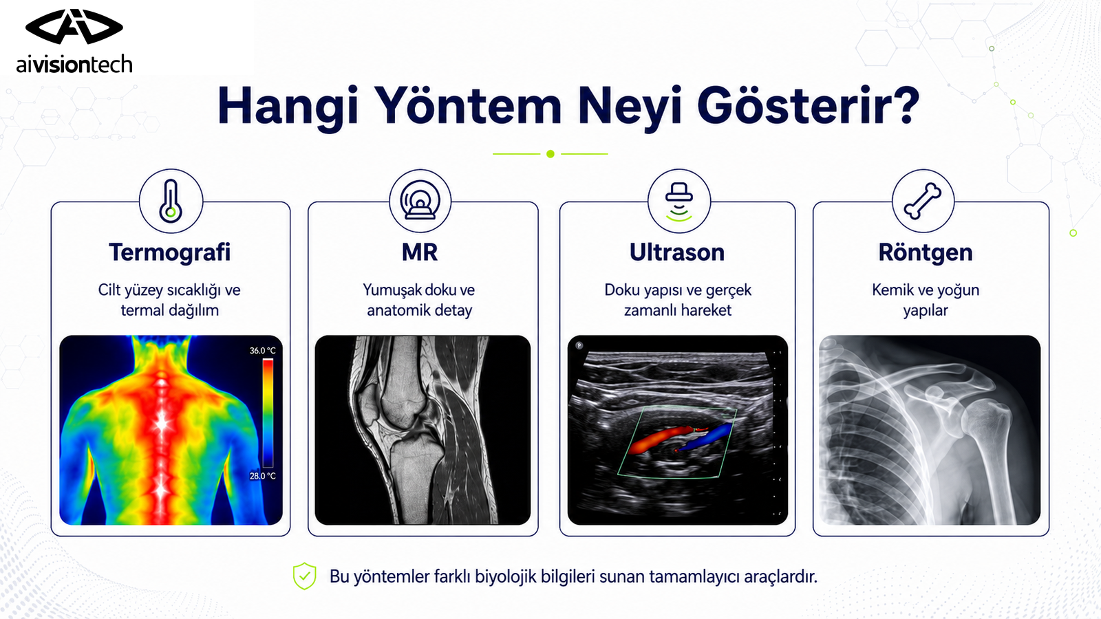 Termografi ve Klasik Görüntüleme Farkı 1 Termografi, MR, ultrason ve röntgen yöntemlerinin karşılaştırılması