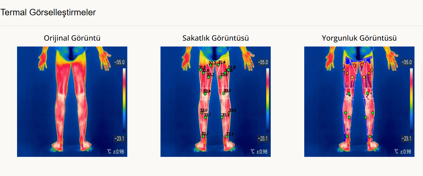 Exemples de visualisations thermiques axées sur les blessures et la fatigue à partir d’une image thermique brute