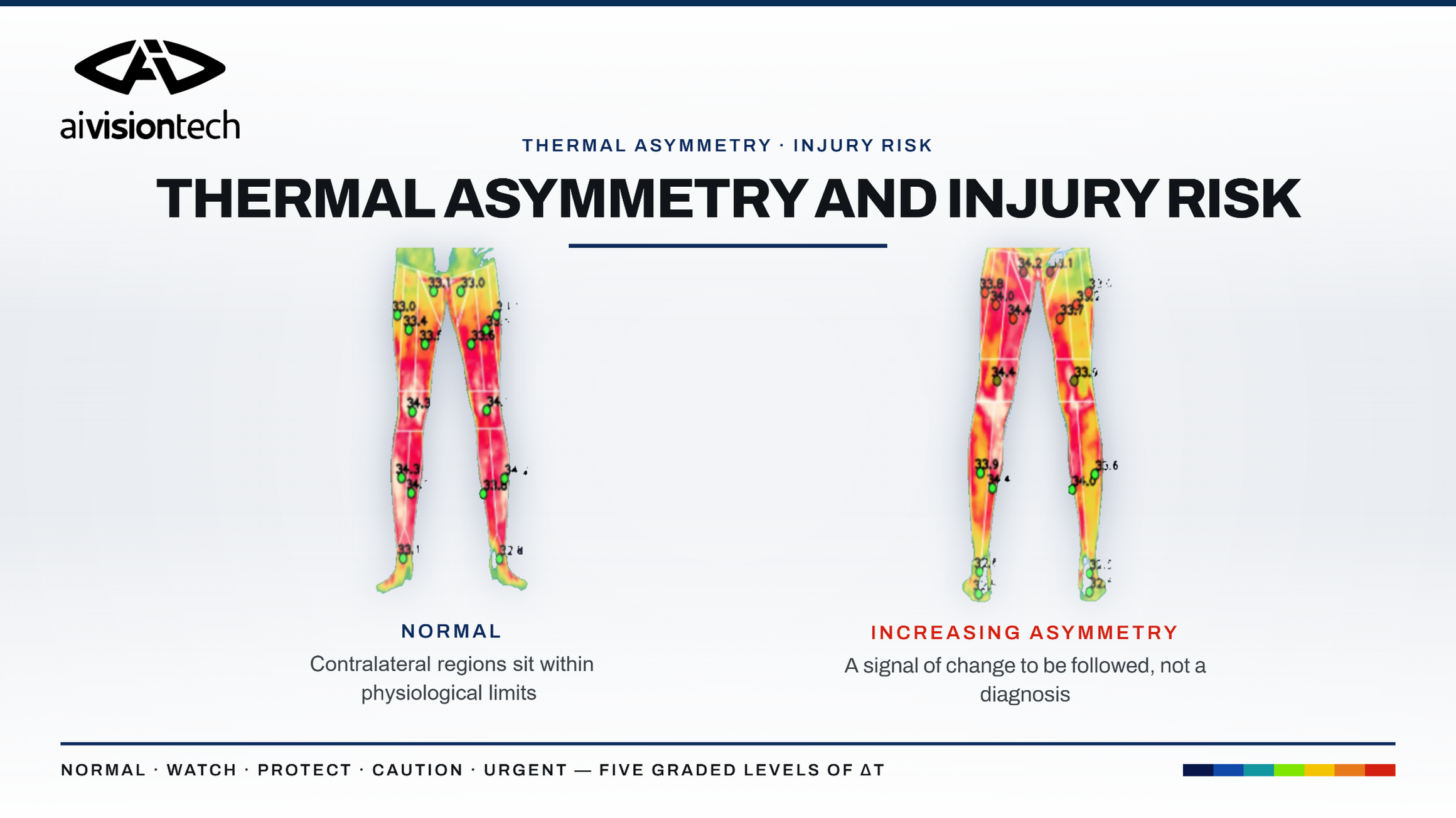 Comparison of normal thermal symmetry and increasing right-left leg temperature asymmetry