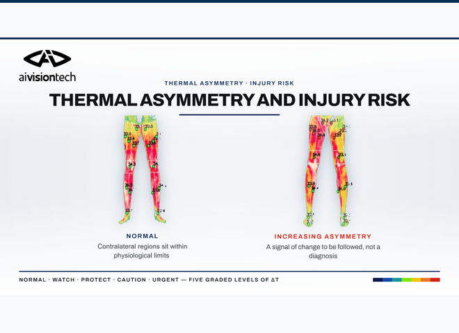 Comparison of normal thermal symmetry and increasing right-left leg temperature asymmetry