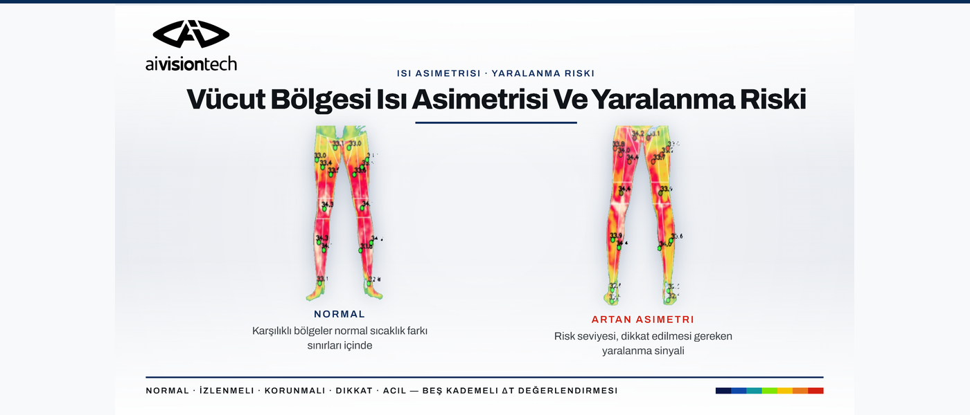 Normal termal simetri ile artan sağ-sol bacak ısı asimetrisinin karşılaştırılması