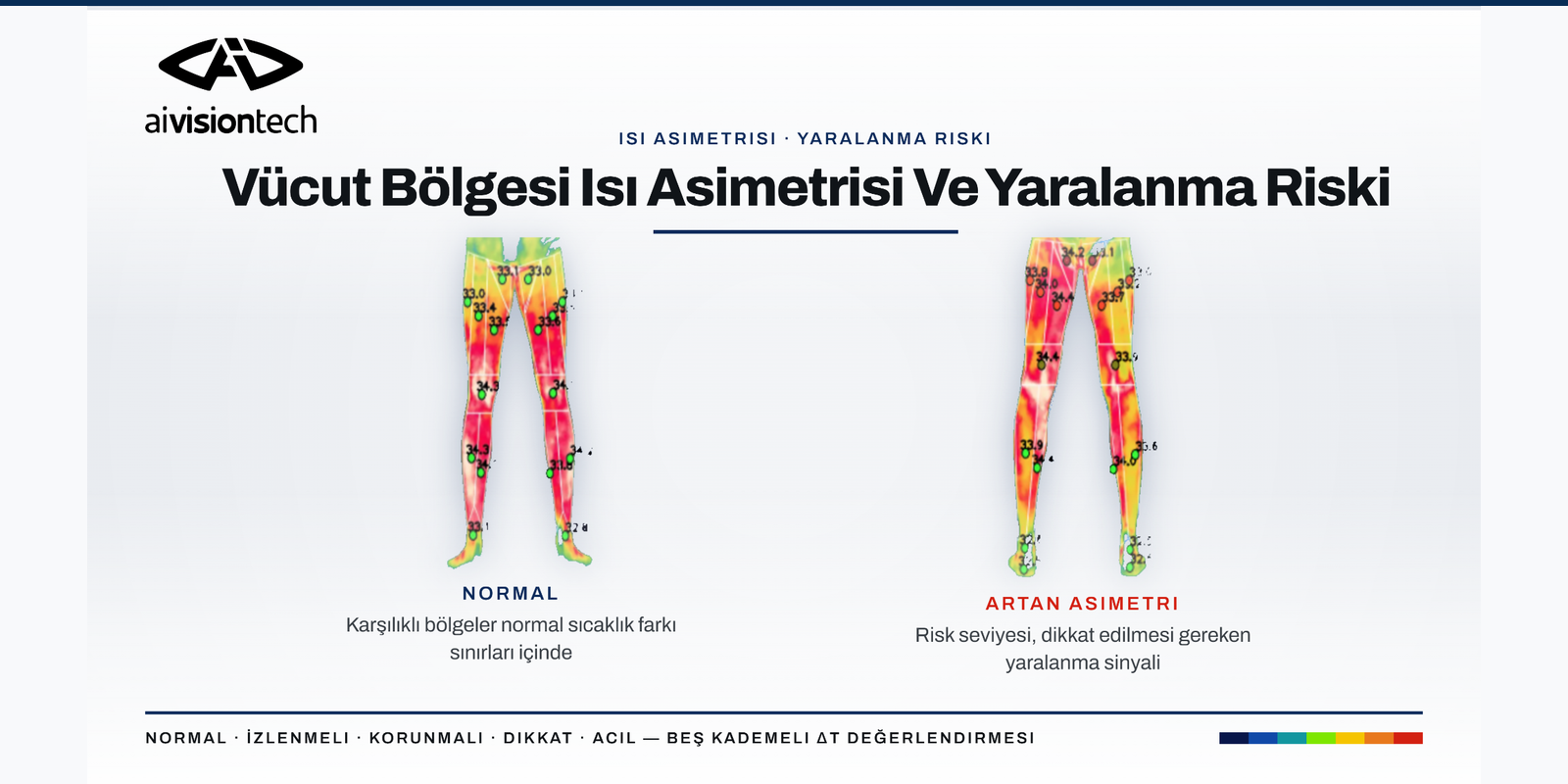 Normal termal simetri ile artan sağ-sol bacak ısı asimetrisinin karşılaştırılması