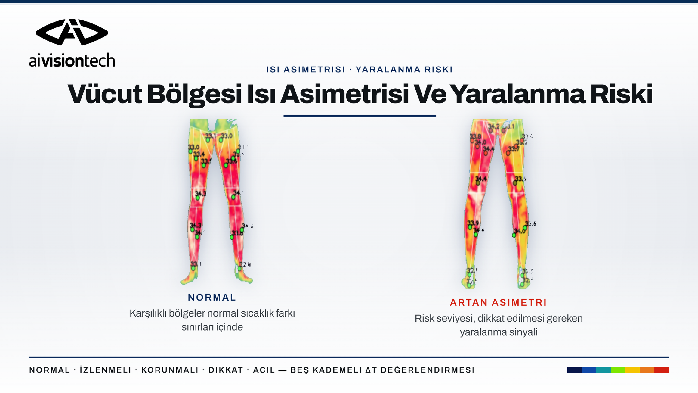 Normal termal simetri ile artan sağ-sol bacak ısı asimetrisinin karşılaştırılması