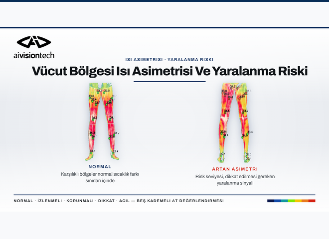 Normal termal simetri ile artan sağ-sol bacak ısı asimetrisinin karşılaştırılması