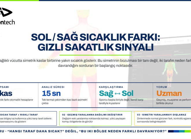 Sol ve sağ kas bölgelerindeki sıcaklık farklarının yorumlanmasını açıklayan aivisiontech infografiği